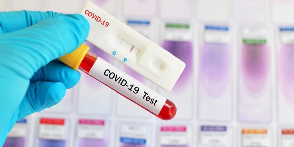 COVID-19 کا پتہ لگانے کے لیے ریپڈ ٹیسٹ کا استعمال کیسے کیا جاتا ہے۔