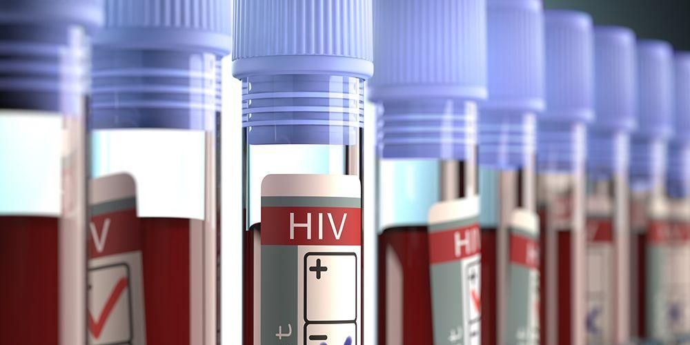 HIV:n hoitaminen ja mahdolliset infektio-oireet