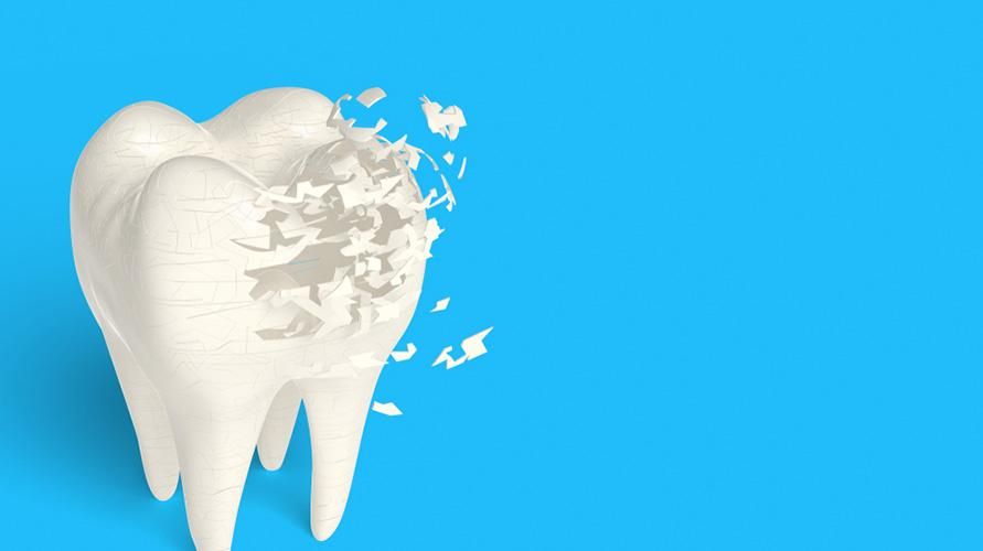 ٹوٹے ہوئے اور ٹوٹے ہوئے دانت؟ Dentinogenesis Imperfecta کی نشانیاں ہو سکتی ہیں۔