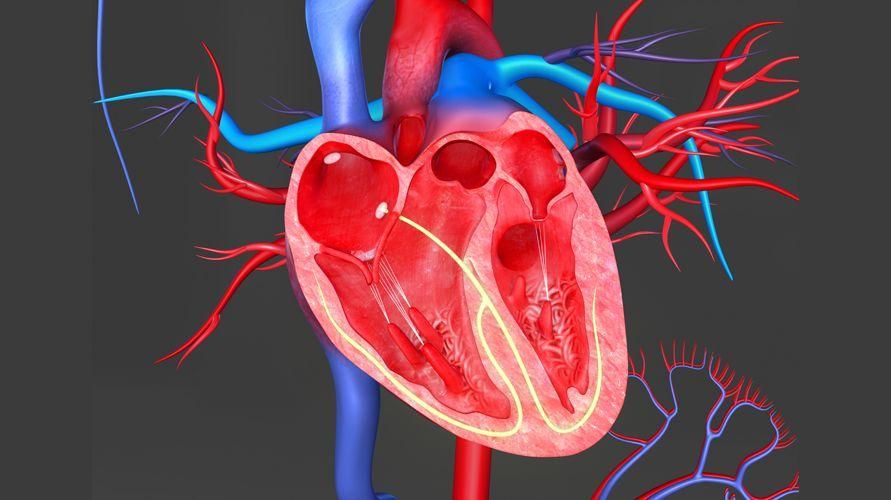 Kilalanin ang Tetralogy of Fallot, isang bihirang congenital heart defect