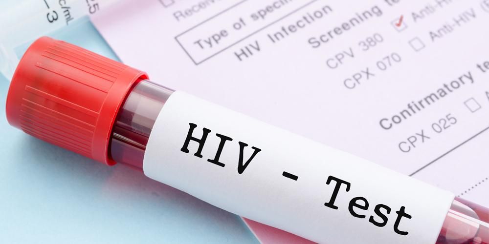 Bigyang-pansin ang mga sumusunod kung nahatulan ng HIV positive