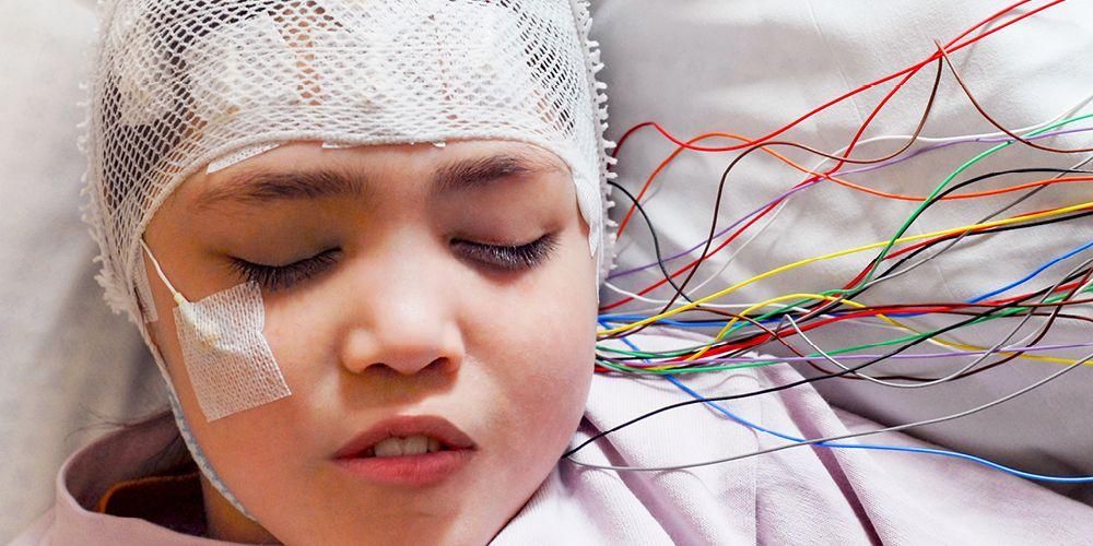 Qual é o efeito da epilepsia no desenvolvimento infantil?