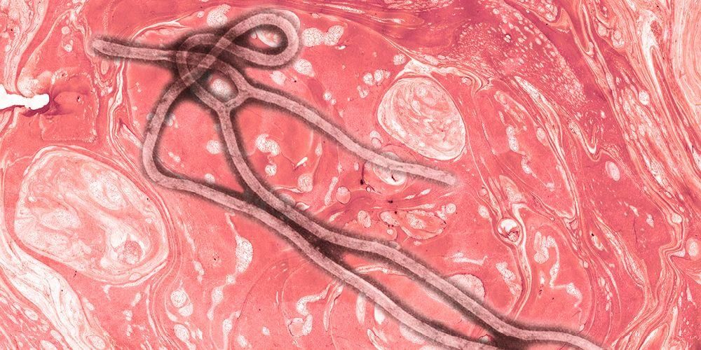 Muling Kumalat ang Ebola sa Africa, Hindi Nanganganib ang Indonesia
