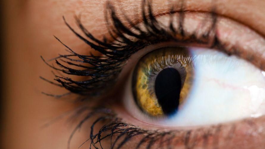 Colobom, onemocnění, které způsobuje, že oči vypadají roztrhané