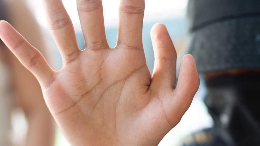 A polidactilia é um distúrbio que faz com que uma pessoa tenha dedos extras nas mãos ou nos pés
