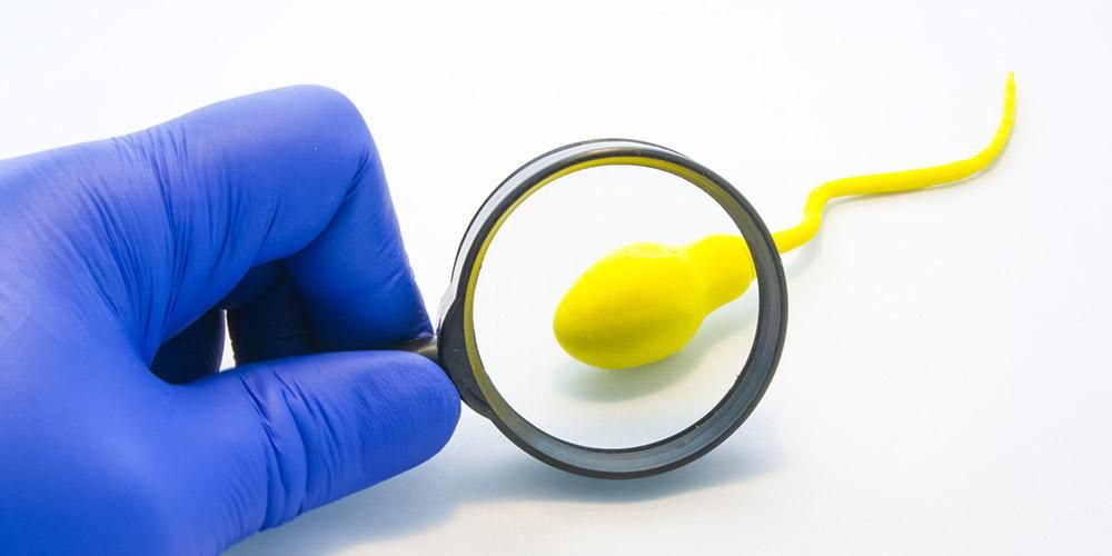 Você já experimentou as causas do esperma amarelo nos homens?