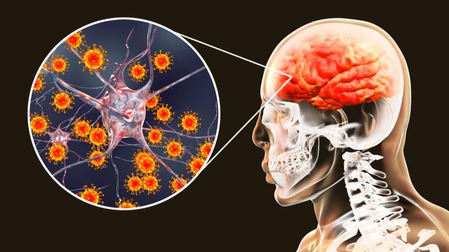 Typy mozgových infekcií a symptómy, na ktoré si treba dať pozor