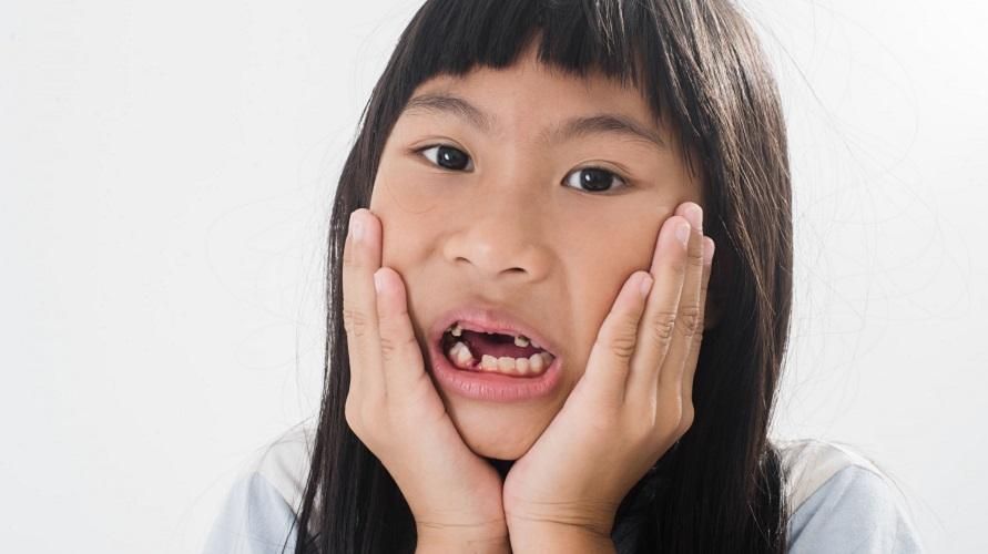 Nguyên nhân khiến trẻ bị gãy răng và cách chăm sóc, cha mẹ cần biết