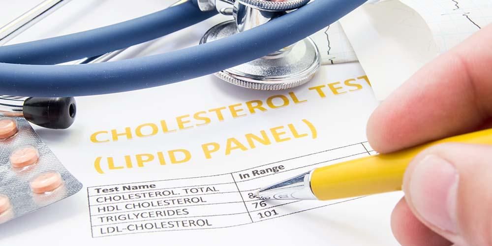 A ligação entre o ácido úrico e o colesterol é importante saber
