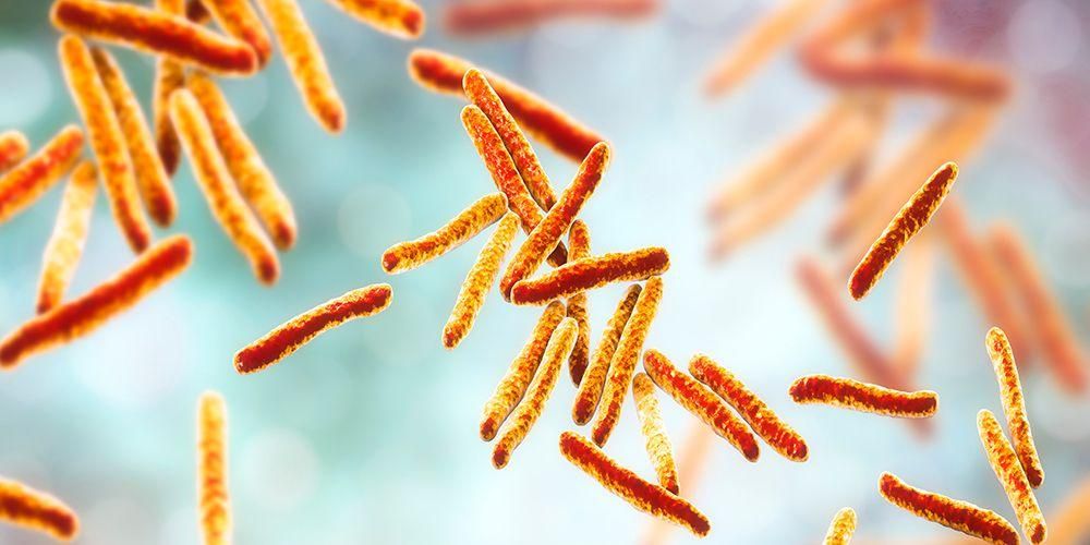 Bakterijska okužba tuberkuloze, kdaj je nalezljiva?