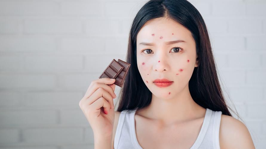 Alergie na čokoládu: Rozpoznejte příznaky