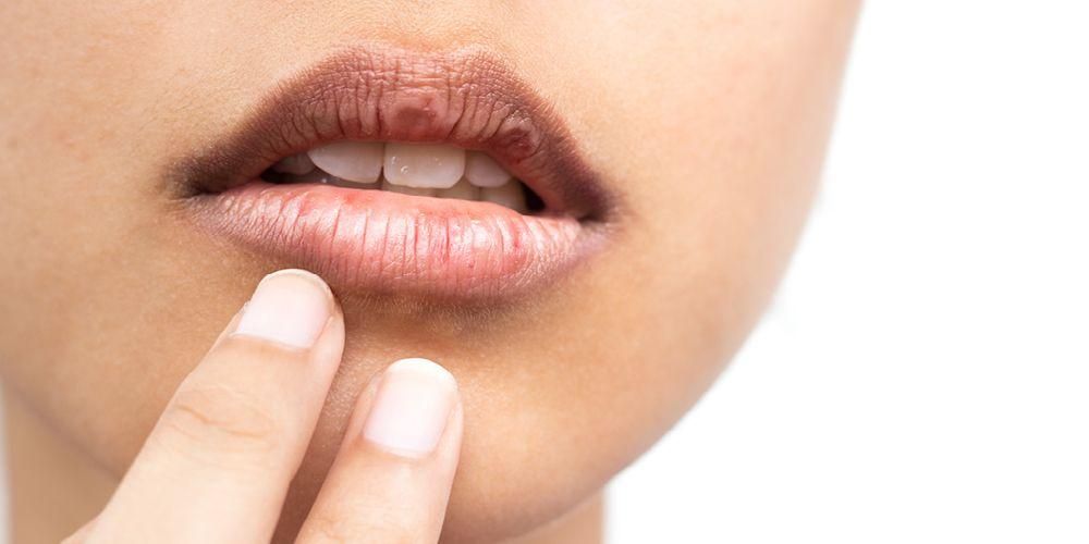 Atpazīstiet 6 sausuma mutes cēloņus un to, kā to pārvarēt