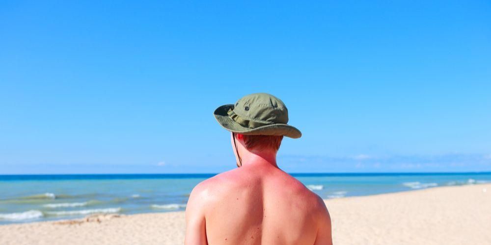 Uzziniet, kādi ir saules alerģijas simptomi un kā to pārvarēt