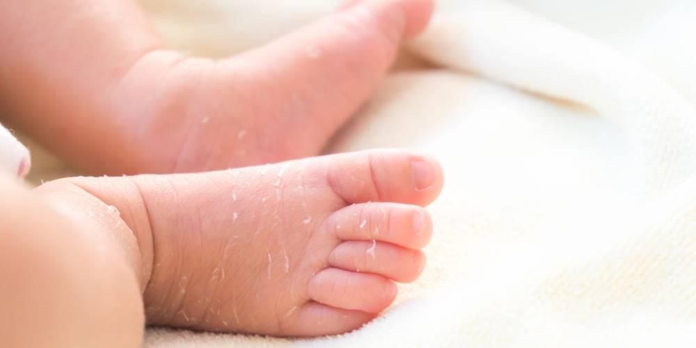 Babys hudafskalning, disse årsager og hvordan man overvinder det