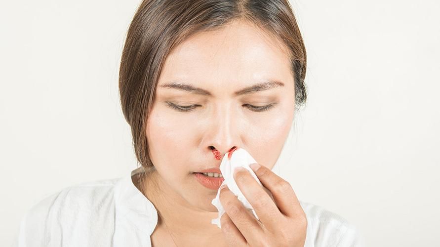 5 trin til næseblod førstehjælp korrekt og hurtigt