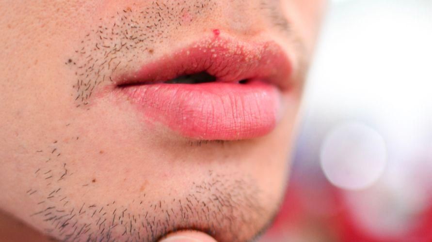 10 αιτίες που μυρμηγκιάζουν τα χείλη που δεν πρέπει να υποτιμάτε