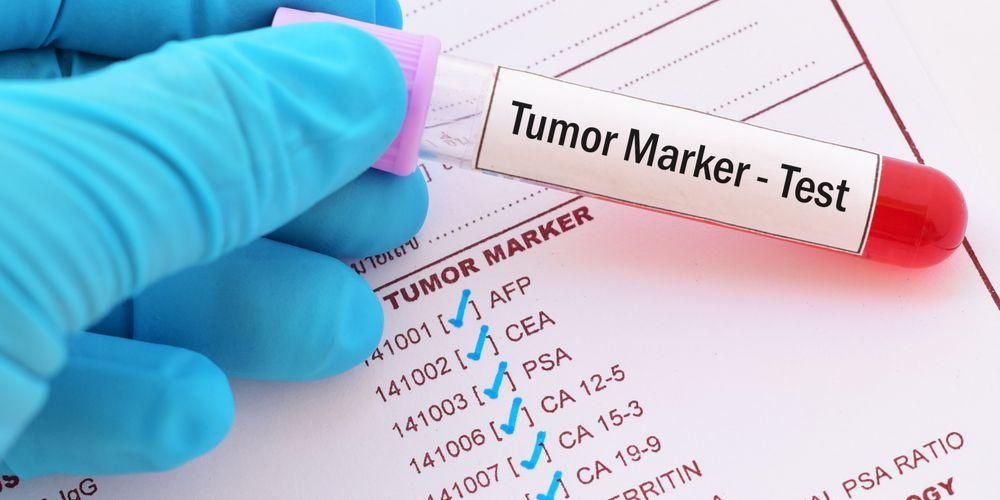 Studium nádorových markerů a jejich funkcí při detekci rakoviny