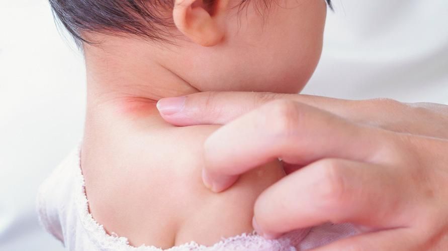 Butllofes al coll del nadó, aquestes causes i com superar-les