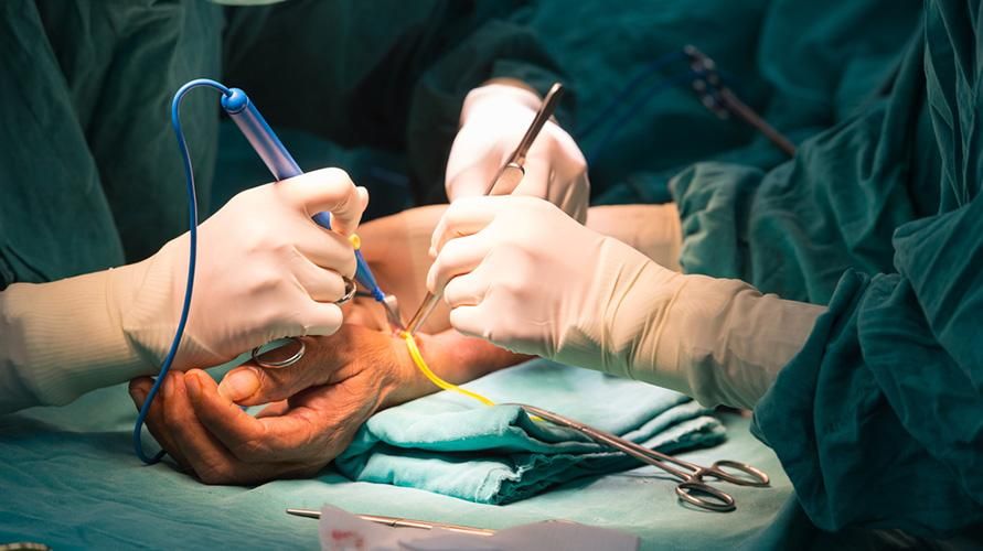 Kako premagati arteriovenozno fistulo s kirurgijo Cimino?