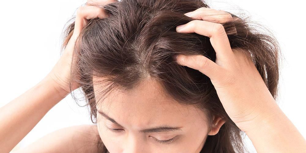 Seboreisk dermatitt i hodebunnen er forskjellig fra flass, her er hvordan du overvinner det