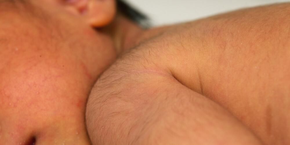 Раст фине косе (Лануго) по целом телу бебе, да ли је то нормално?