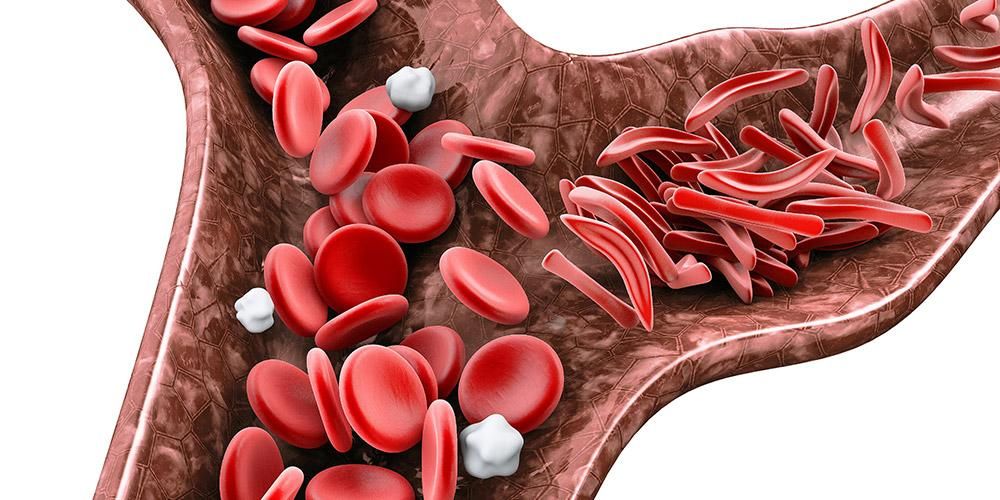 خون کی کمی کی اقسام کم سرخ خون کے خلیات کی وجہ سے ہوتی ہیں۔