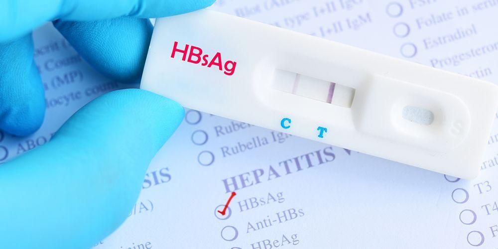 HBsAg، ایک خون کا ٹیسٹ جس کا مقصد ہیپاٹائٹس بی کا پتہ لگانا ہے۔