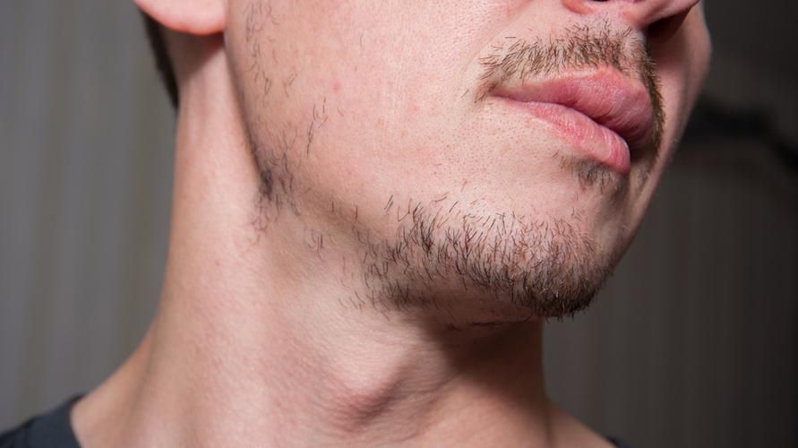 Узроци и како да расте танка брада код мушкараца