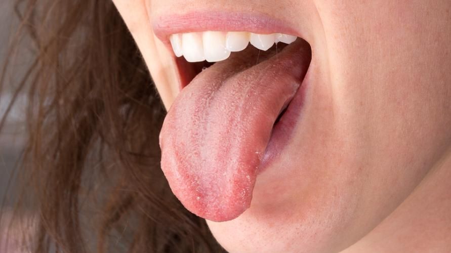 11 syytä heräämiseen katkeraan suuhun, jota on tarkkailtava