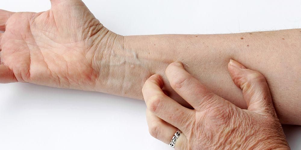 Srbeča starostna koža, to so vzroki in kako se z njimi spopasti
