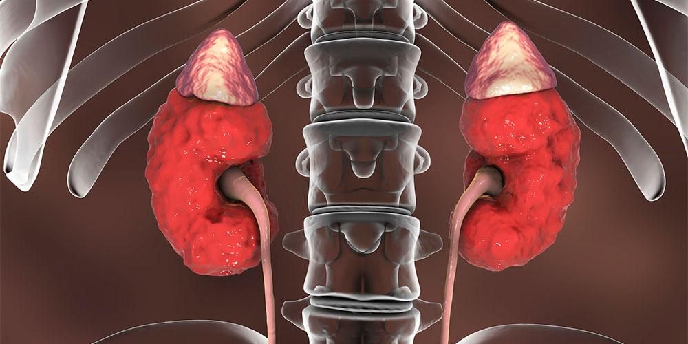 Glomerulonefritis, trastorns de la funció renal que cal tenir en compte