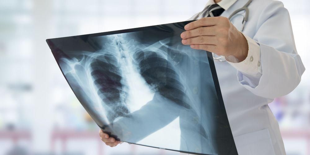Siin on röntgenikiirguse eelised keha tervise kontrollimiseks