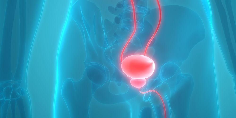 Betændelse i prostata: typer, årsager og symptomer at bemærke