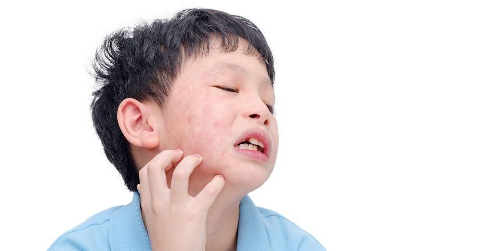 小心，这是儿童腮腺炎引起的 6 种并发症！