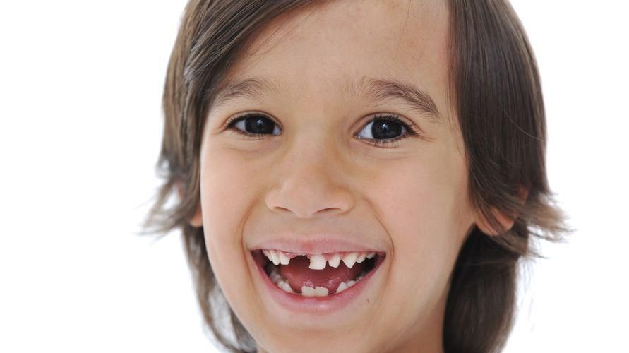 Saugokitės hipodontijos, jei jūsų dantys vis dar neauga