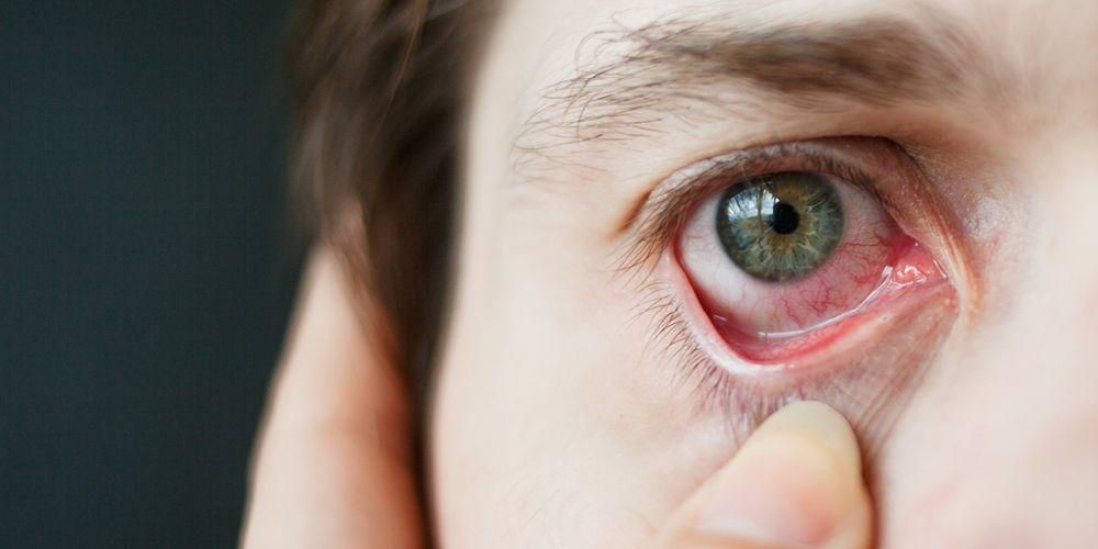 Øjensygdomme på grund af diabetes, der forårsager sløret syn og andre komplikationer