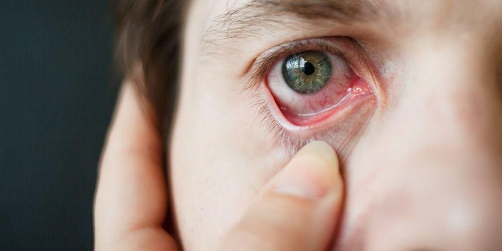 Silmade vitamiinid, mis on kasulikud tervise säilitamiseks