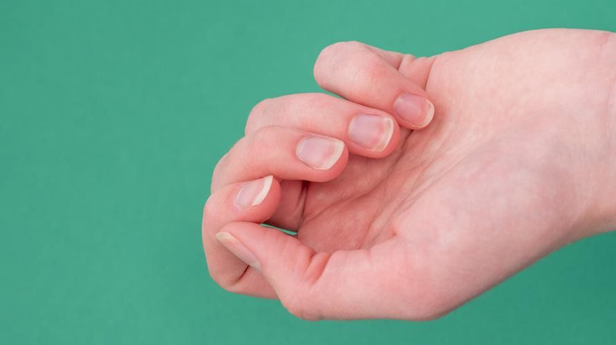 Årsager til neglepitting, der gør negle ujævne og blege