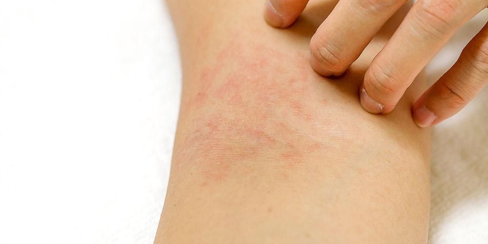 بچوں میں سردی کی الرجی پر قابو پانے کے 7 موثر طریقے